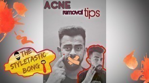 How To Get Rid Of Acne Fast (Mens skin care routine )