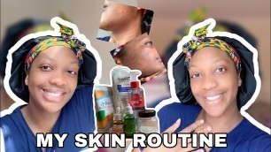 MY FULL SKINCARE ROUTINE FOR ACNE PRONE/COMBINATION SKIN 2020| VIKKIOGAH