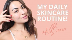 SKINCARE ROUTINE UPDATE: ADULT ACNE | Daniela Pires - Health & Beauty Coach