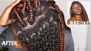 CUTTING OUT MY BRAIDS|REMOVING BUILD UP FROM 4C NATURAL HAIR|Lynda Jay