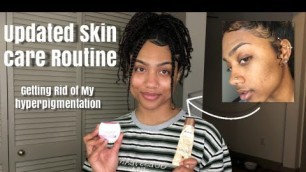 Updated Skin Care Routine: Getting Rid of Hyperpigmentation