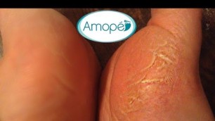 Amope Pedi Perfect Unboxing and Trial #sandalfeet