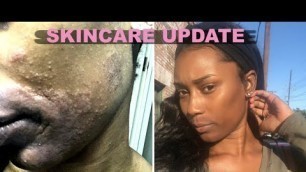 SKIN CARE UPDATE: ALLERGIC REACTION & HYPER-PIGMENTATION?