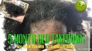 Nasty!! Taking Down My 5 MONTH Old Braids