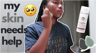 My MORNING Skincare Routine 2020 | Acne Prone Skin W/ Hyperpigmentation