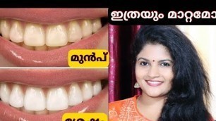 'Tooth Whitening at Home |SimpleTips Malayalam | Beauty Channel'