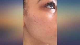 Ambi Skincare Fade Cream, Normal Skin, 2 oz (56 g) (packaging may vary) review