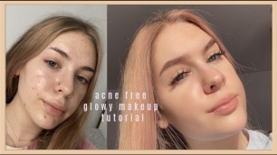 glowy af FOUNDATION FREE acne focused makeup tutorial *read description*