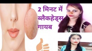 'How to remove blackhead from nose | Blackheads kaise hataye / Chandigarh Beauty Channel'