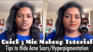 Quick 5 min makeup tutorial/ Tips to cover acne scars & hyperpigmentation | simple everyday makeup |