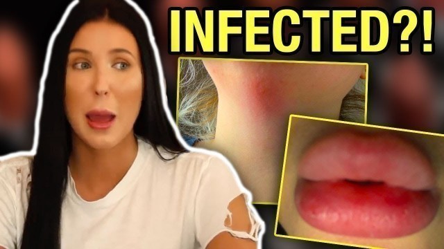 'JACLYN HILL\'S LIPSTICKS ALLEGEDLY CAUSED ALLERGIC REACTIONS AND BACTERIAL INFECTIONS'