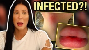 'JACLYN HILL\'S LIPSTICKS ALLEGEDLY CAUSED ALLERGIC REACTIONS AND BACTERIAL INFECTIONS'