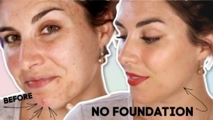 'Cover Acne Scars WITHOUT Foundation? | Bailey B.'