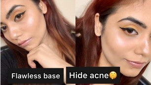 'Full acne coverage foundation base 2020| Hide acne scars|full coverage on acne|'
