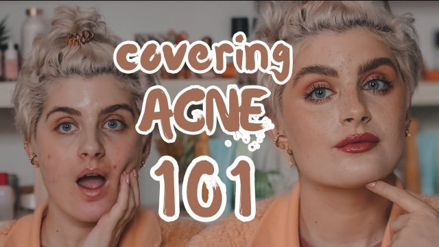 'Makeup for Dummies: COVERING ACNE 101 | Raquel Mendes'